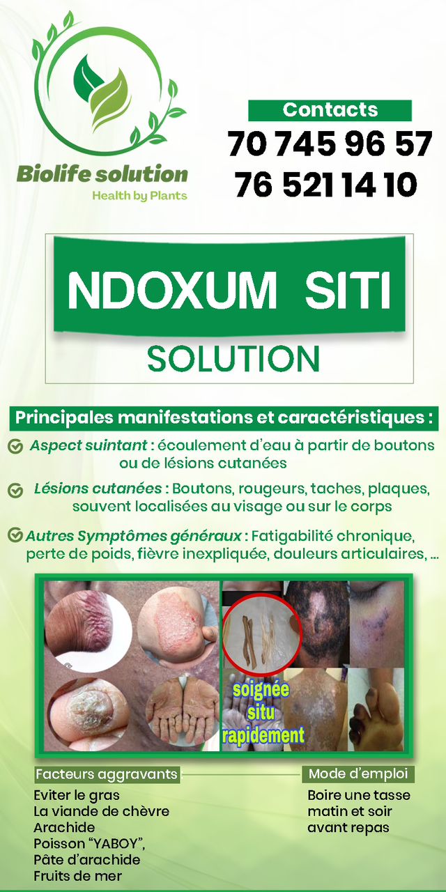 TRAITEMENT NDOXOUM SITI